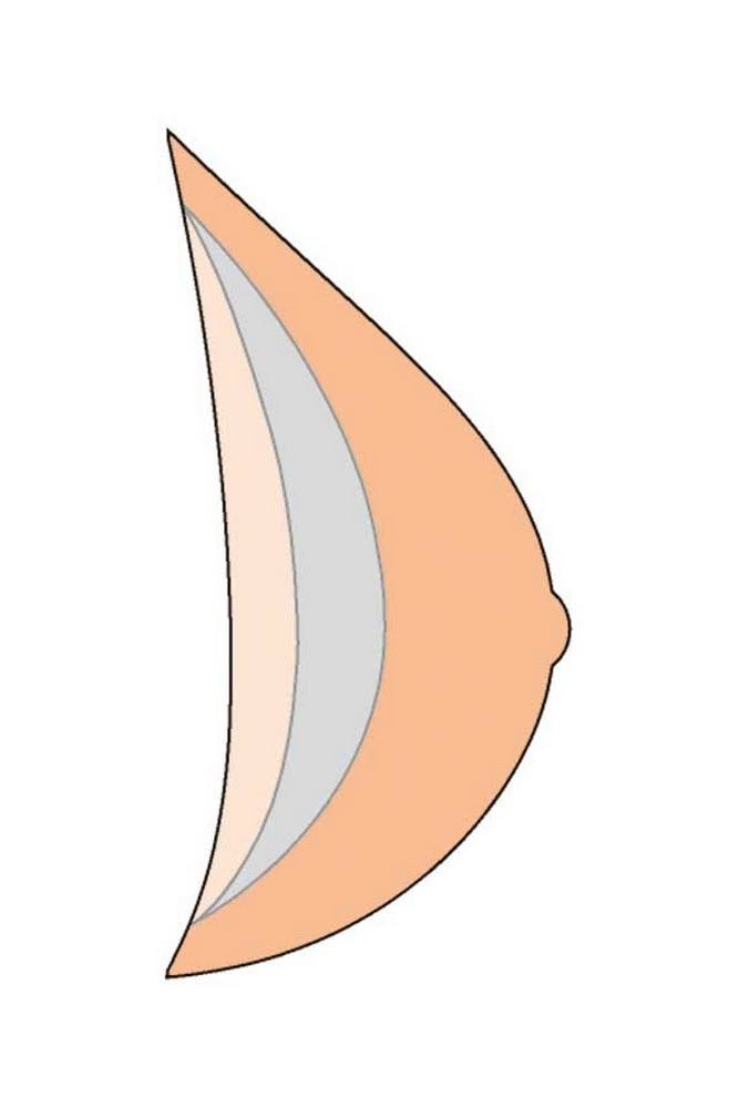 Natura Xtra Light Breast Form Size 8 O6917
